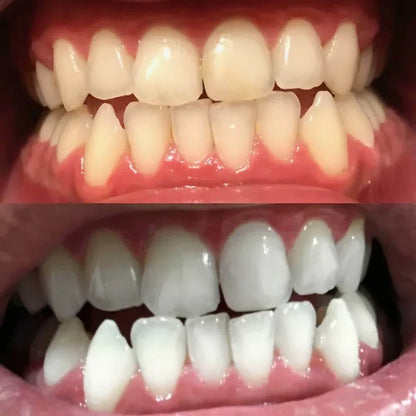 Pióro do wybielania zębów Diamond Smile